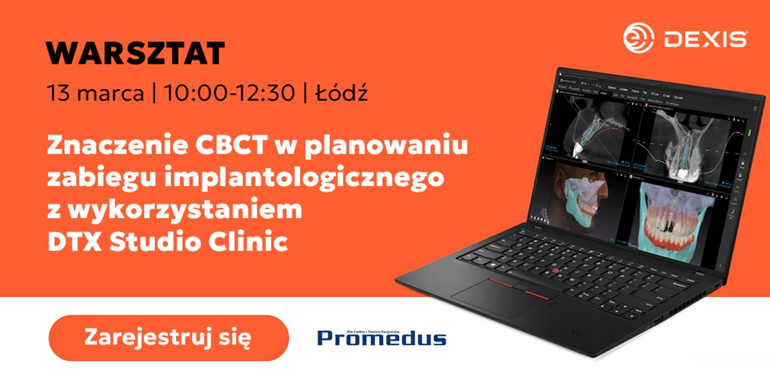 Znaczenie CBCT w planowaniu zabiegu implantologicznego z wykorzystaniem DTX Studio Clinic