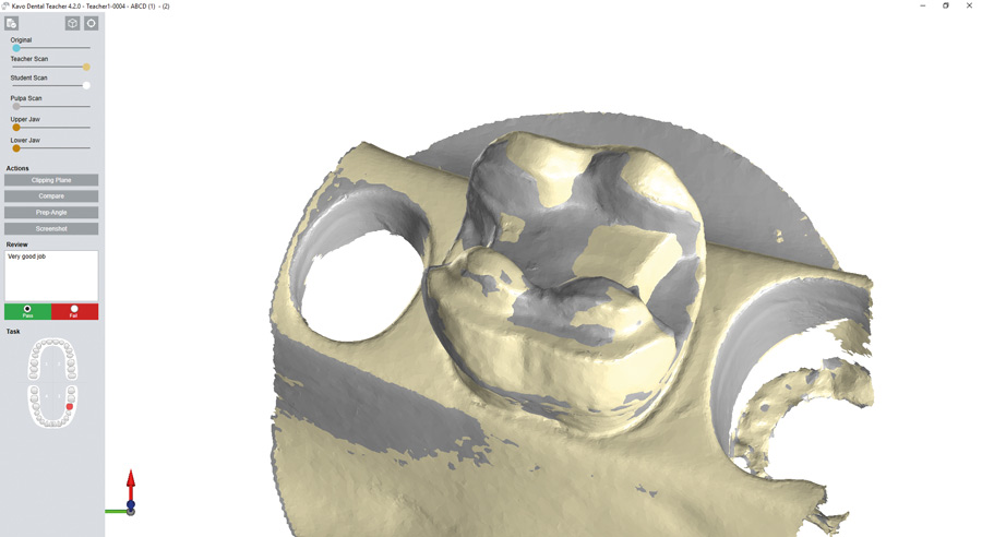 Wizualizacja 3D preparacji KaVo
