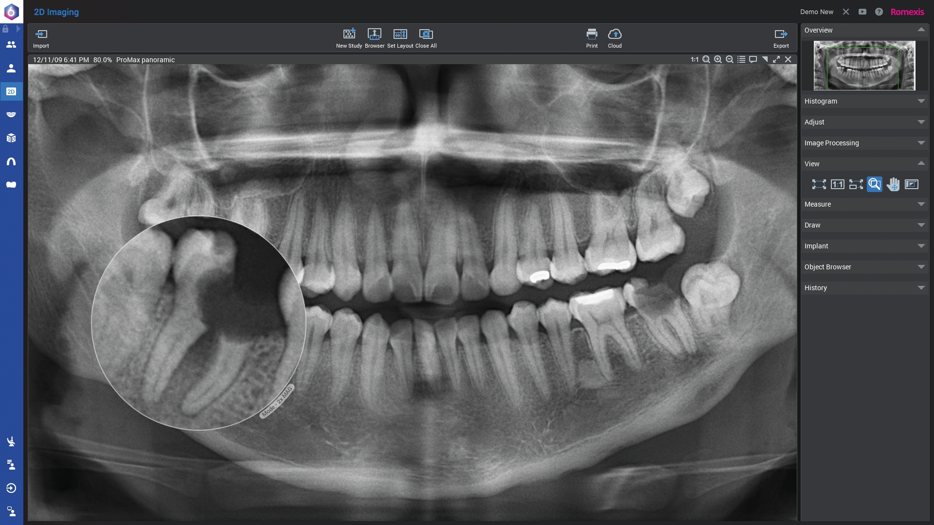 Planmeca ProMax 2D S3 Promedus 2