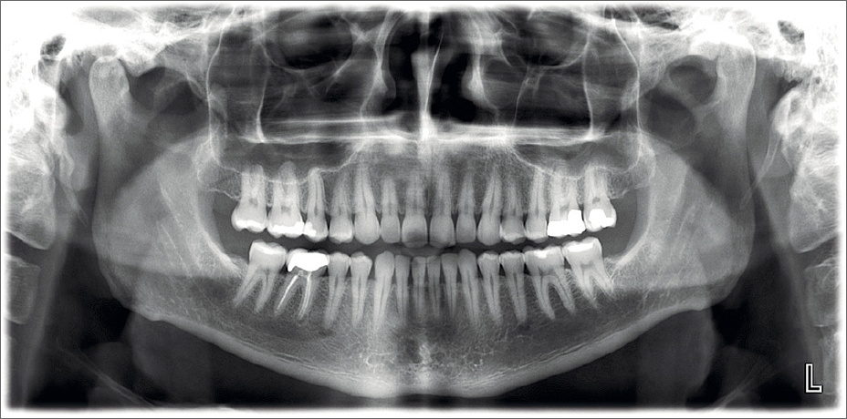Planmeca ProMax 2D S3 Promedus 5