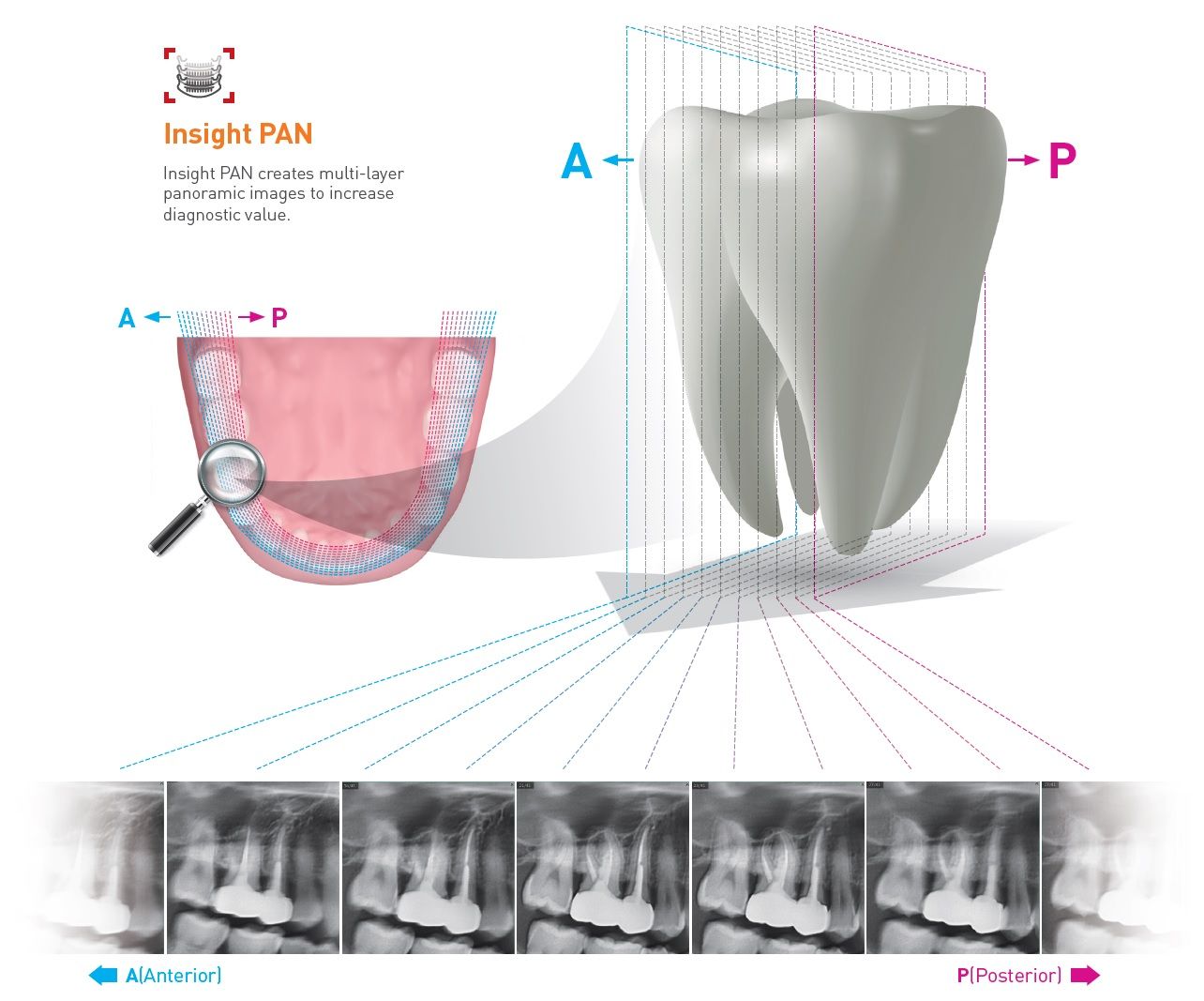 Vatech Pax i Insight Promedus 2
