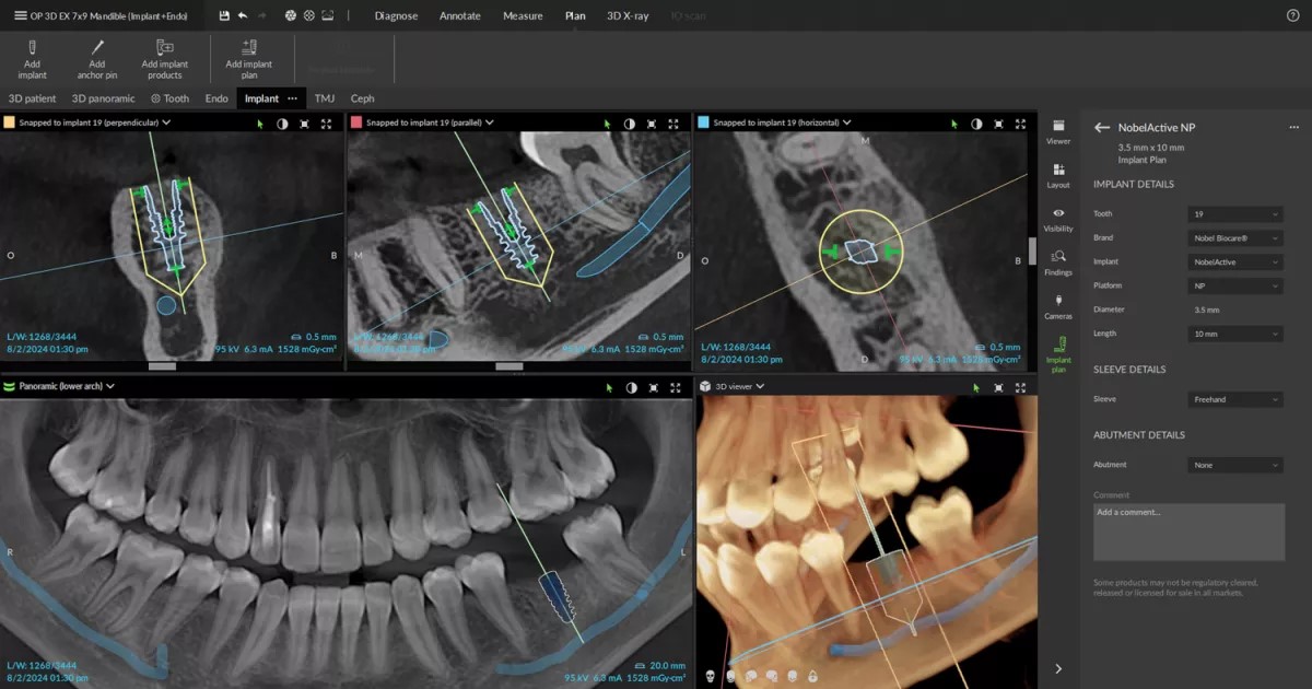 Implant Placement DEXIS OP 3D EX