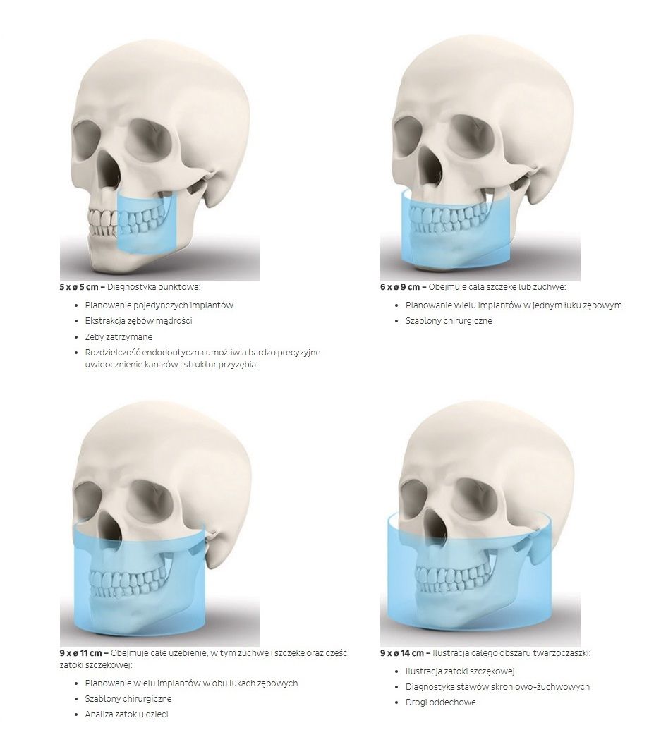 KaVo OP 3D Promedus Pola Obrazowania