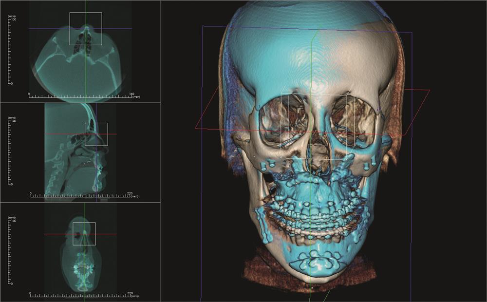 KaVo Op 3D VISION Chirurgia szczękowo twarzowa