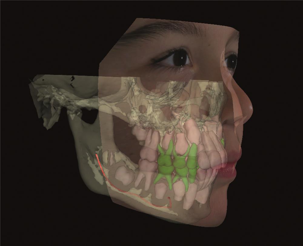 KaVo Op 3D VISION ortodoncja