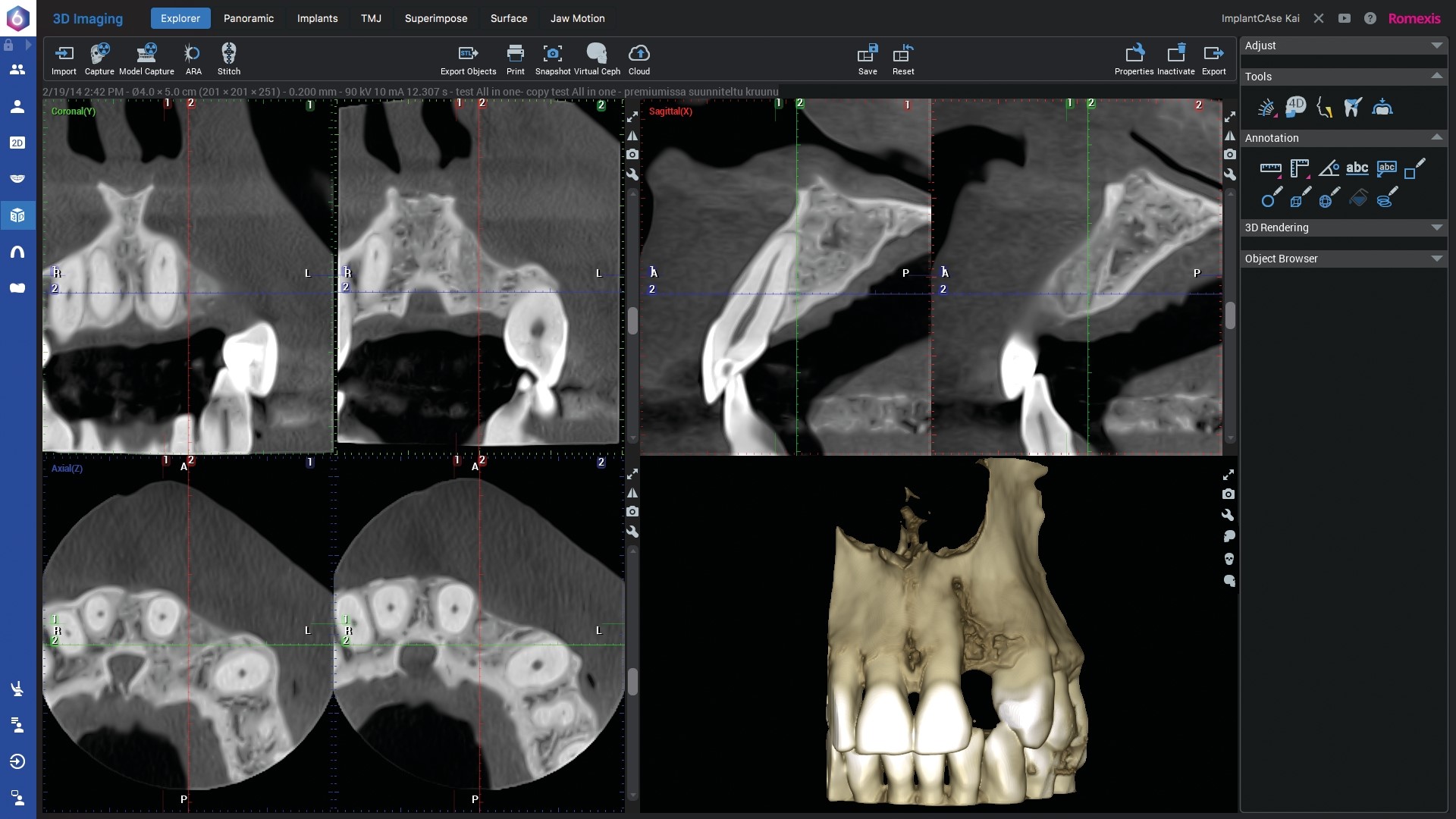 Planmeca ProMax 3D Classic Promedus 5