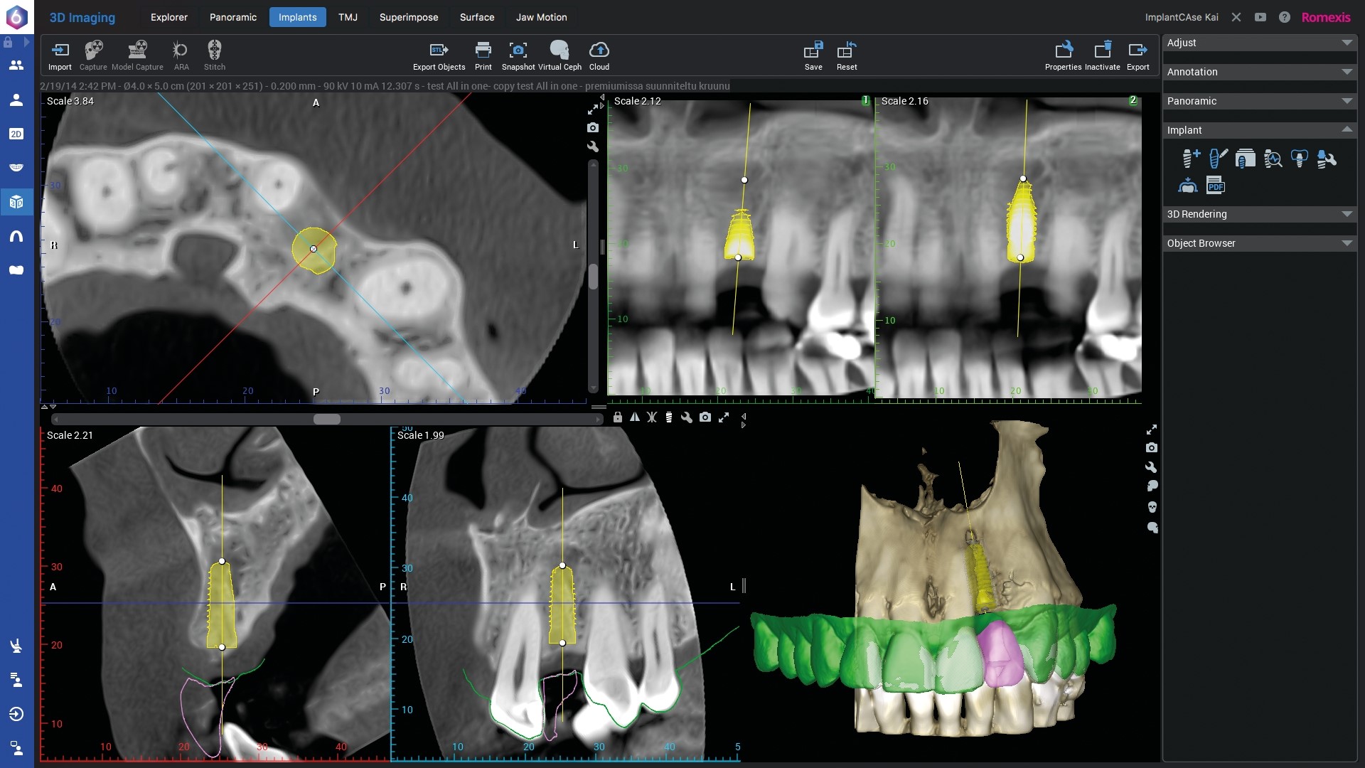 Planmeca ProMax 3D Classic Promedus 6