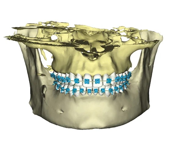 Planmeca ProMax 3D Classic Promedus 9