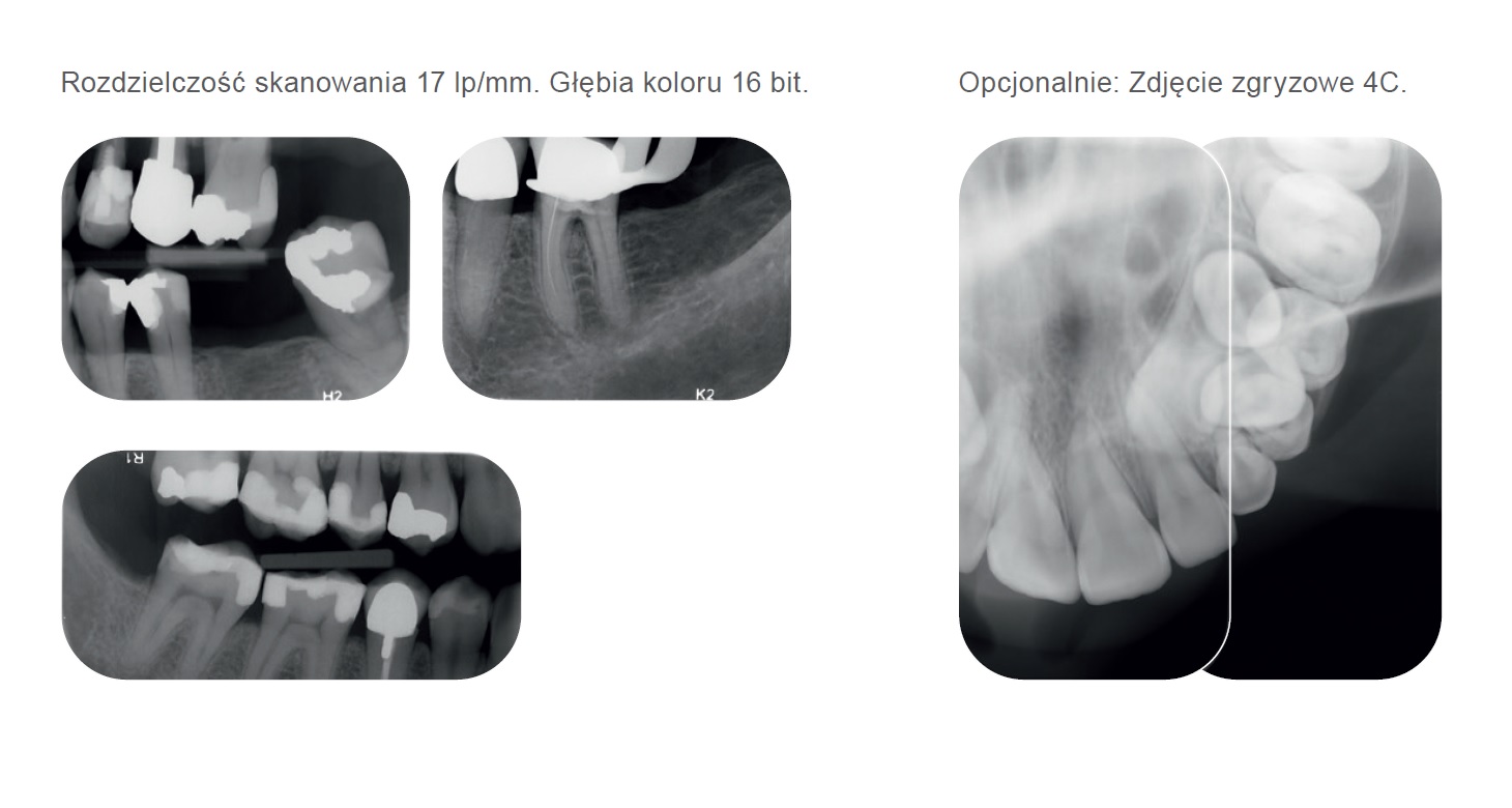 DEXIS Scan eXam One Promedus 4