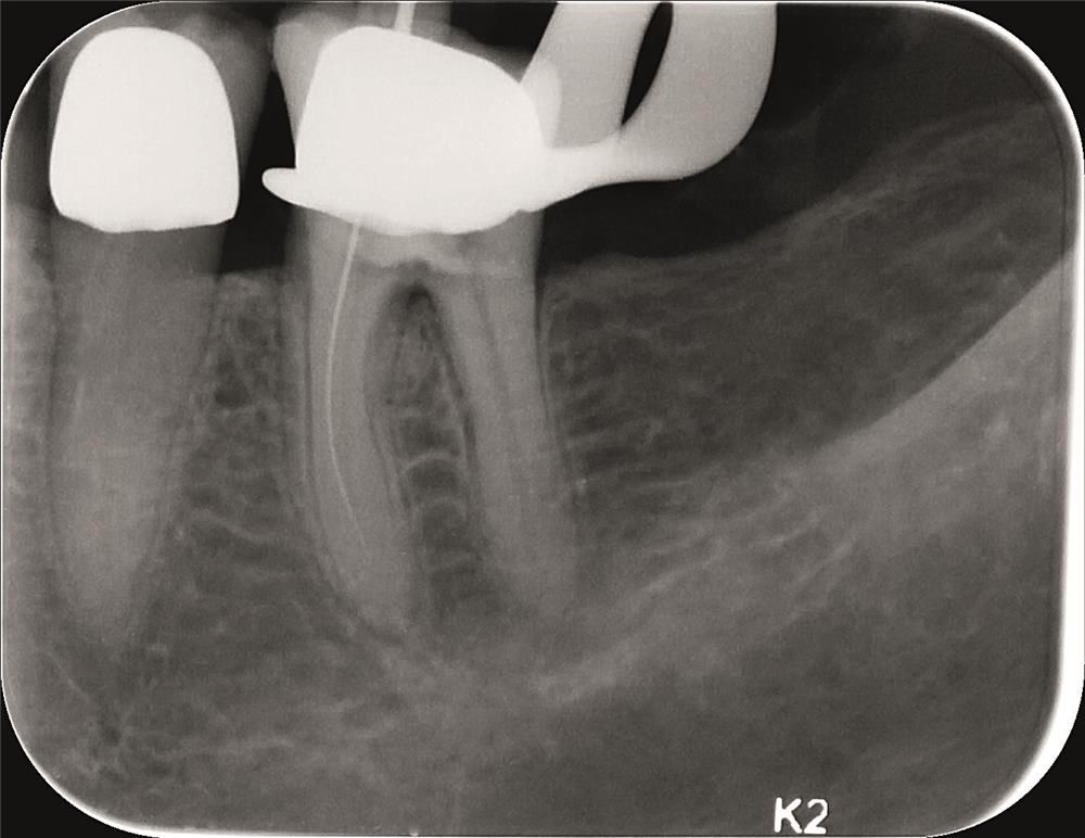 KaVo Scan eXam Promedus 3