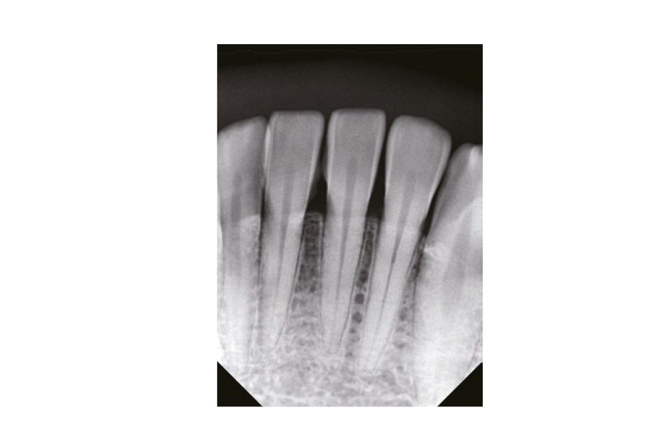 VATECH EzSenso Soft 4 Promedus
