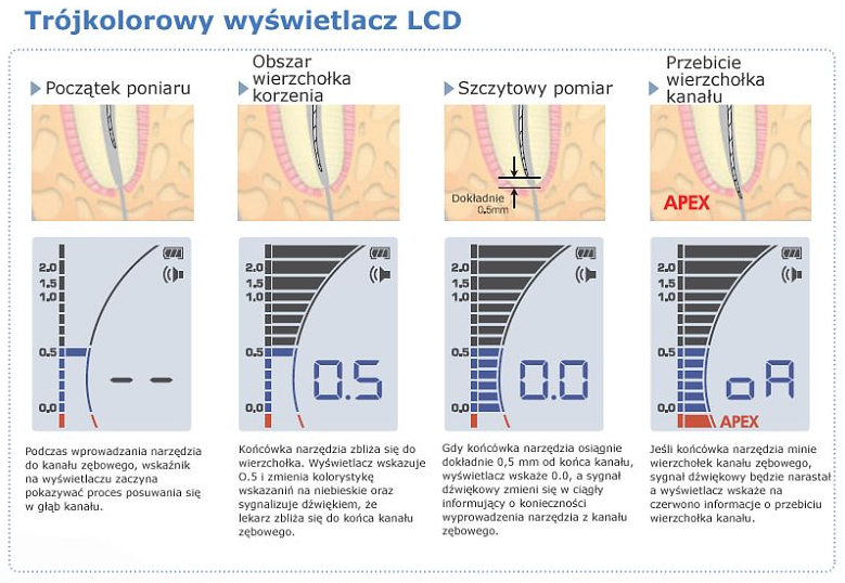 iPex II - endometr firmy NSK - Promedus autoryzowany dystrybutor