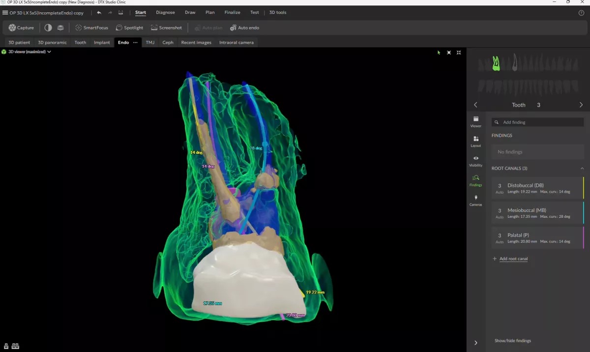 ENDO DTX STUDIO CLINIC DEXIS