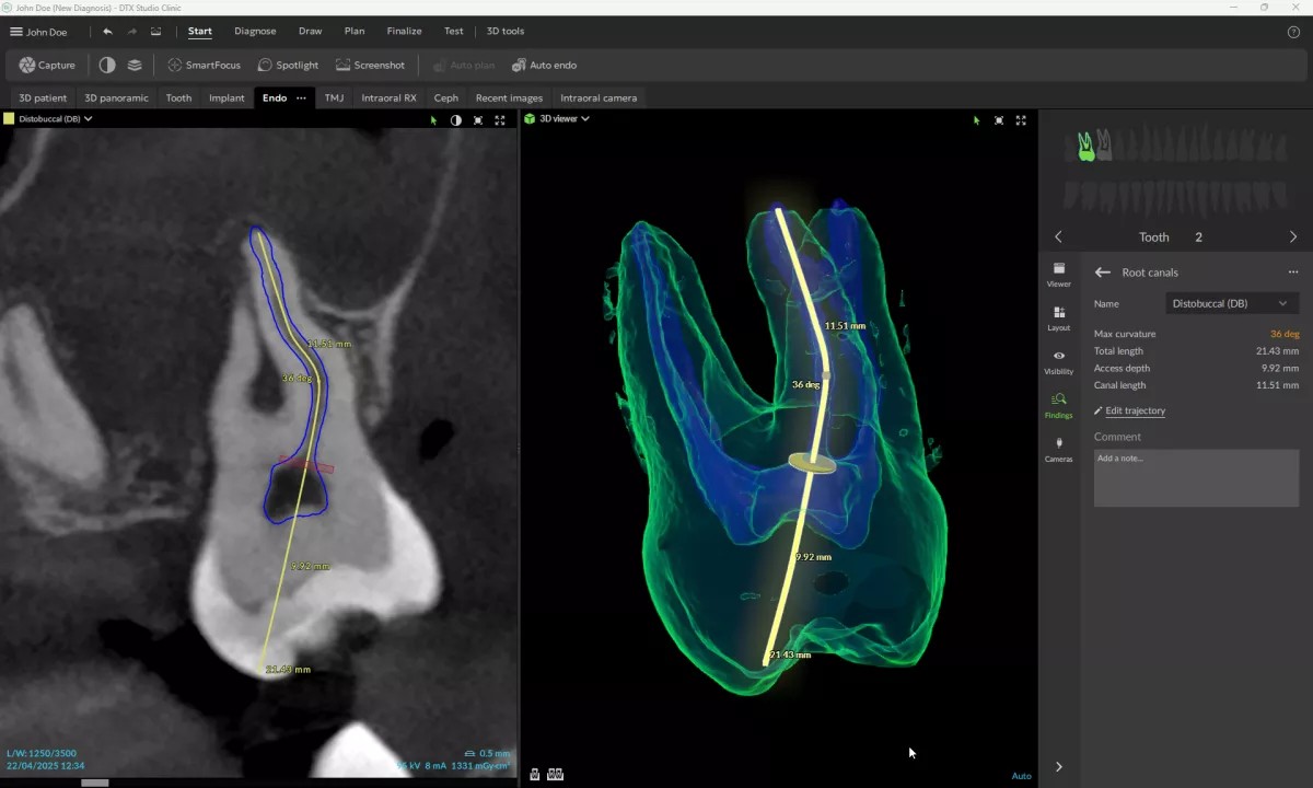 ENDO DTX STUDIO CLINIC DEXIS 1 automatyczne mapowanie kanałów