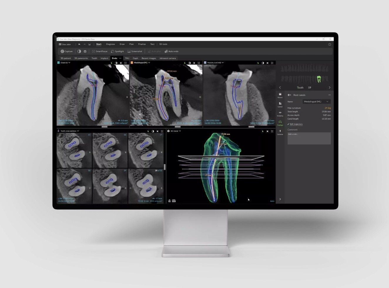 ENDO DTX STUDIO CLINIC DEXIS 4.1