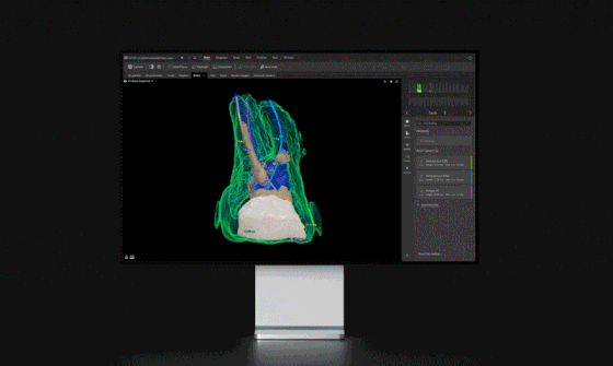 ENDO DTX STUDIO CLINIC DEXISvideo