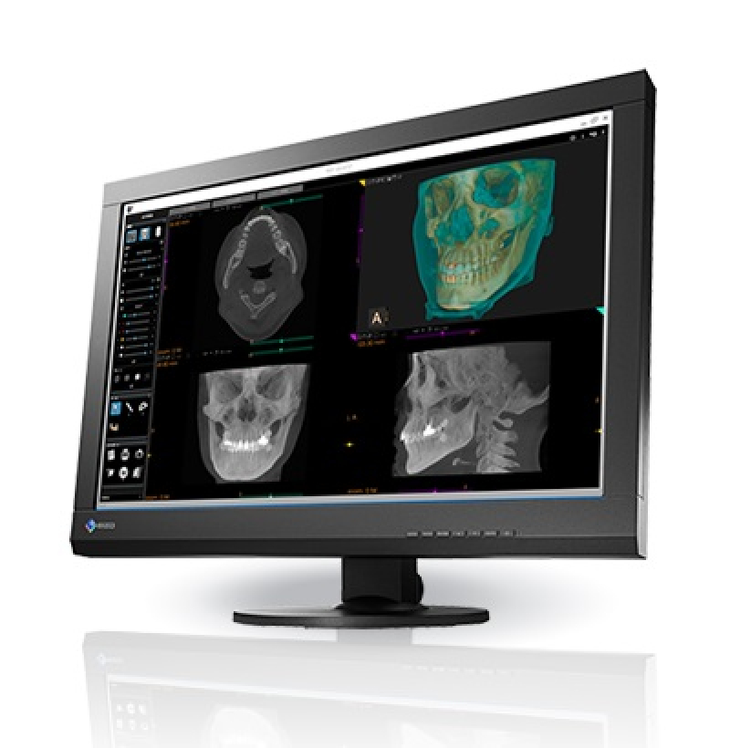 Eizo MX242W - monitor medyczny, stomatologiczny