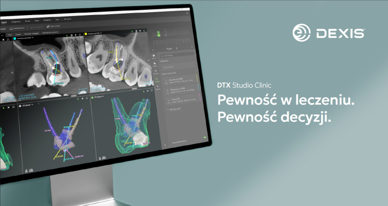 NOWY moduł Endo w DTX Studio&trade; Clinic 4.10 &ndash; jak wspiera diagnostykę i planowanie leczenia kanałowego?