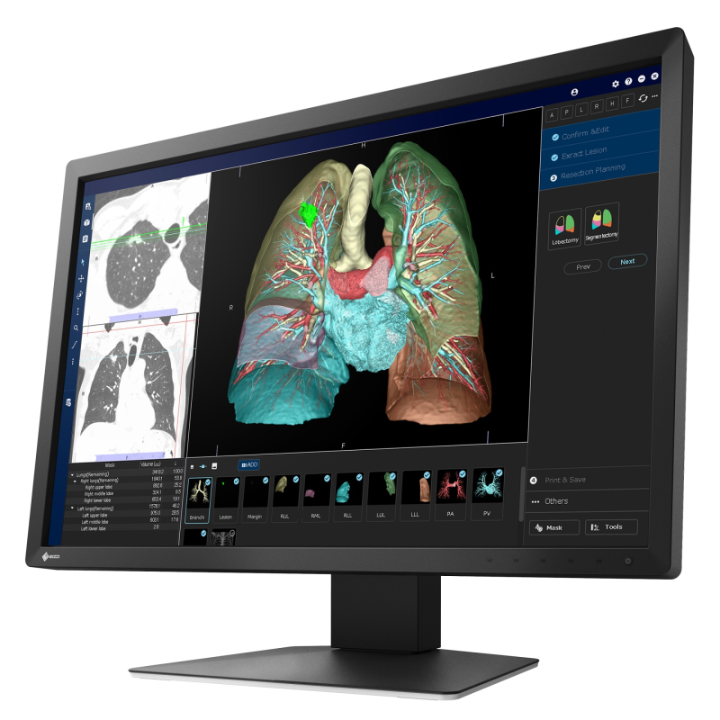 Eizo MX243W - monitor medyczny, stomatologiczny