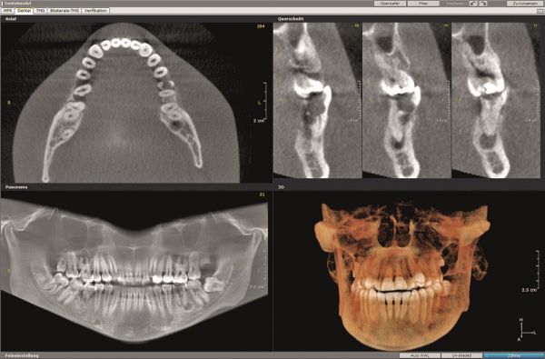 Diagnostyka RTG w endodoncji - szkolenie