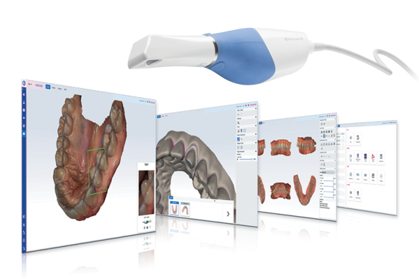 Nowy moduł PLANMECA Romexis® CAD/CAM