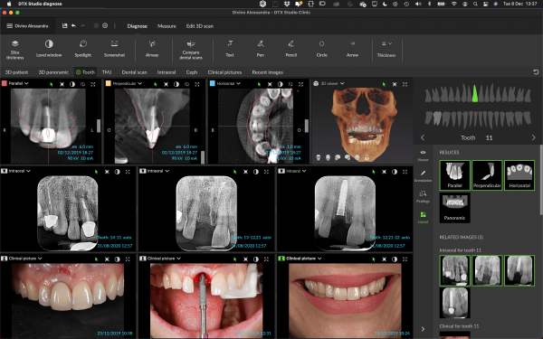 DTX Studio - nowa platforma do diagnostyki badań firmy DEXIS