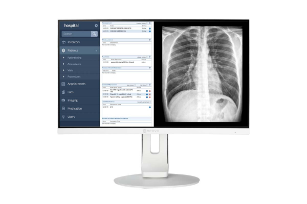 Neovo MD-2402 - monitor medyczny, stomatologiczny